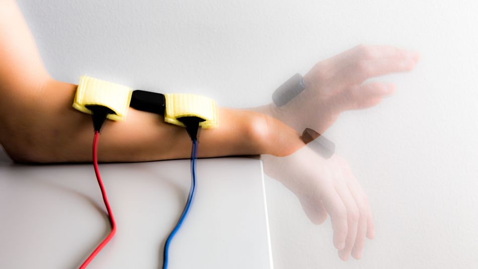 funktionelle Elektrostimulation der Hand eines Schlaganfall-Patienten