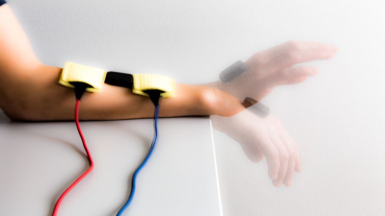 funktionelle Elektrostimulation eines Schlaganfall-Patienten